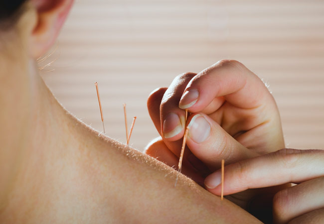 acupuncture-services-active-spine-and-sports-care-ventura-camarillo3