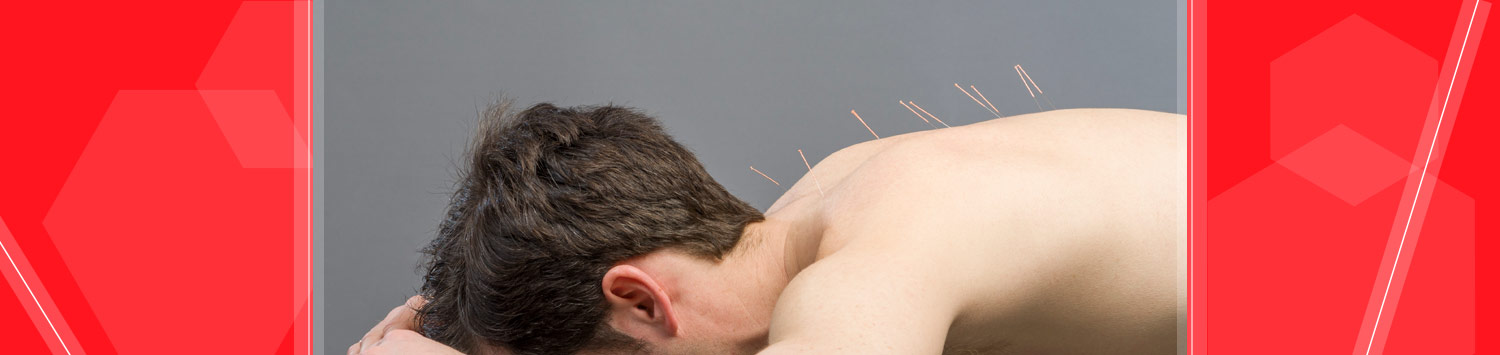 acupuncture-active-spine-and-sports-care-services Camarillo Ventura